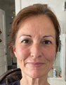 Deborah L., 44