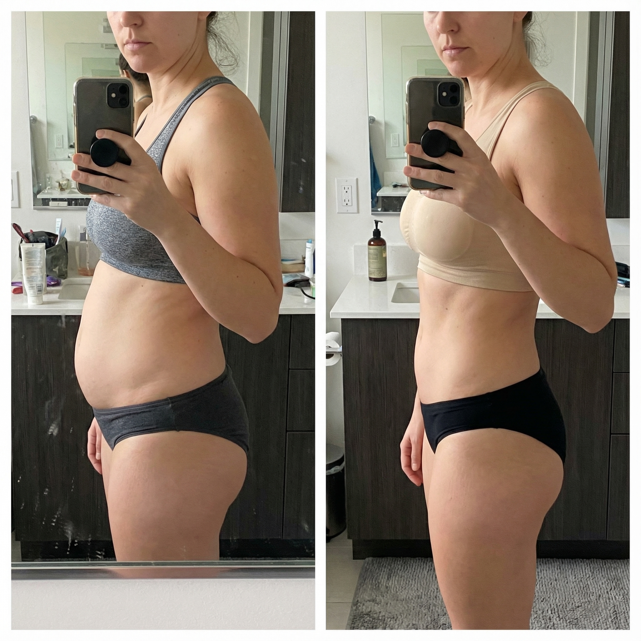 Transformation bottom