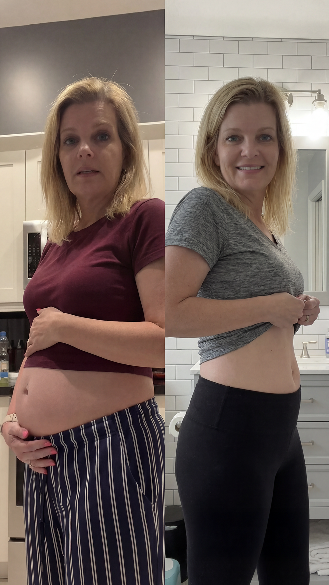 Transformation bottom