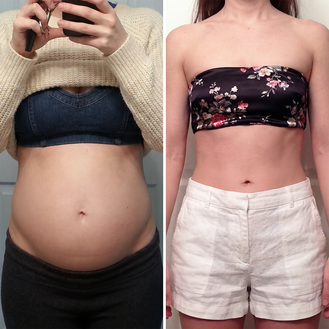 Transformation middle