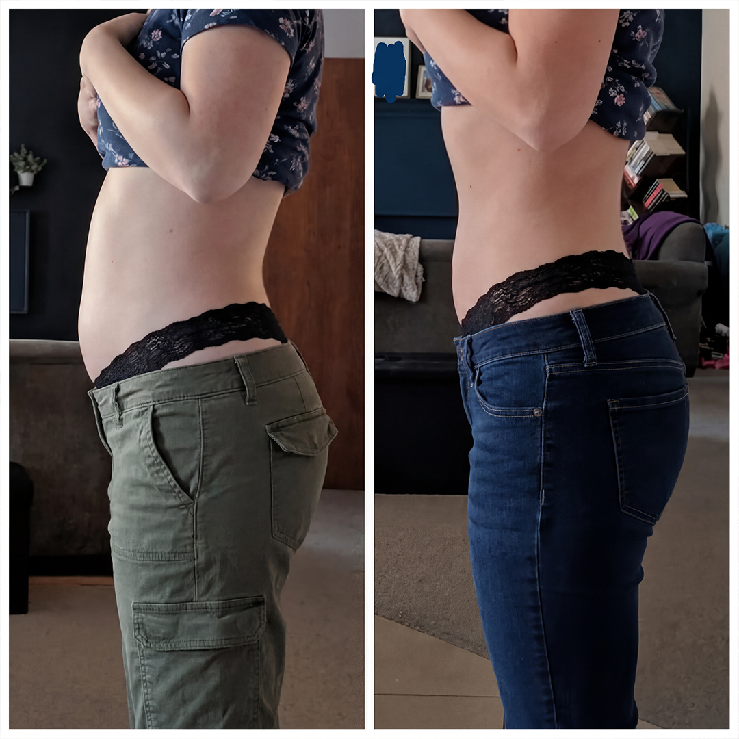 Transformation middle