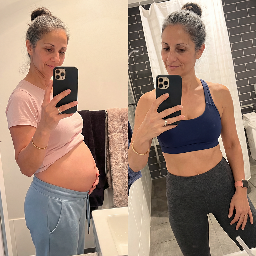 Transformation bottom