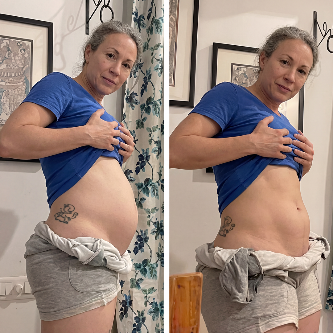 Transformation bottom